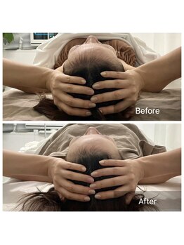 ステラルーテ(Stella lute)/頭の浮腫スッキリ！