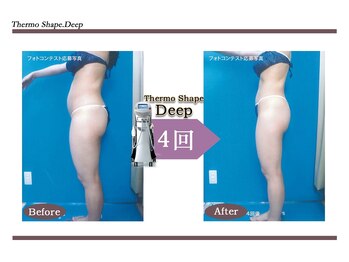 Nビューティー/最新エンダモロジーBODY