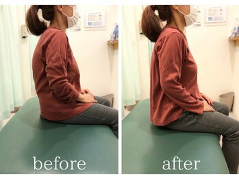 学芸大整体院/７０代×猫背矯正 / BeforeAfter