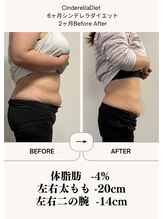 オーシャン整骨院(OCEAN整骨院)/ダイエット6ヶ月コース