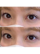 コレットアイビューティー(COLLET EYE BEAUTY)/