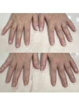 ハッカネイル(HAKKA NAIL)/