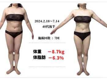 ラヴィ アール(Lavie.R)/痩身/リンパ/リンパマッサージ