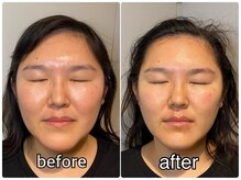 ハロースック 六本木(Hellossook)の雰囲気(リフトアップはお任せください!よもぎ蒸し/ヘッドスパ/小顔)