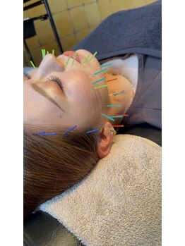 メディカルジャパン 吉祥寺/美容鍼灸