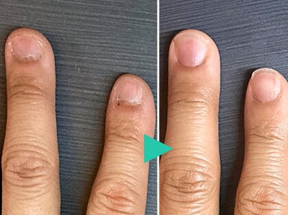 桃の木 吉祥寺店の写真