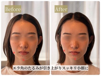 ルーツ 武蔵小杉(R∞ts)の写真