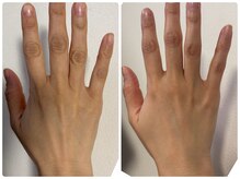 アロラヴィ(AroRavi)/