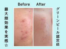 カノン(KANON)/グリーンピール