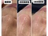 オーダーメイドまつげパーマ×鼻毛穴洗浄トータルケア　￥13,000