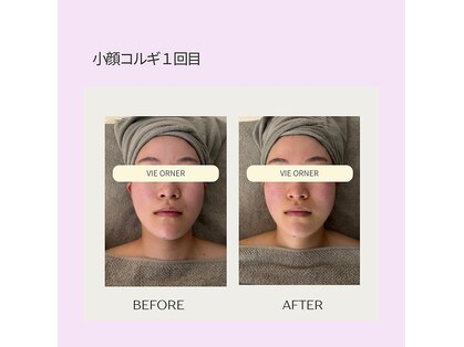ヴィオルネ(VIE ORNER)の写真