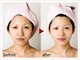 エステティックサロン アタラの写真