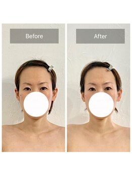 ステラルーテ(Stella lute)/寝ている間に目力アップ！