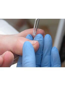 爪の悩みを解消できる（ケア含む）