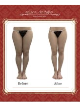 メゾン ド サファリ(maison de Safari)/短時間で驚きの結果◎内股の隙間