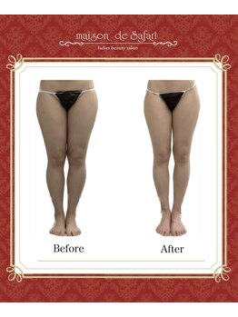 メゾン ド サファリ(maison de Safari)/短時間で驚きの結果◎内股の隙間