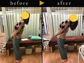 杉本接骨鍼灸院/背骨から全身がユルユル整体