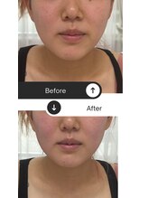 ユウキ(yuuki)/フェイシャルもオススメ！