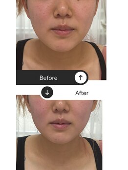 ユウキ(yuuki)/フェイシャルもオススメ！