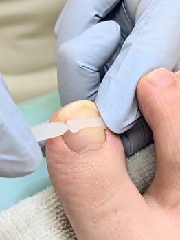 フスフレーゲ 池袋東口店/ケア写真