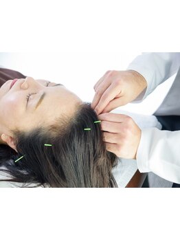 小顔になりたい