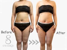 エスラージュ(esoulage)