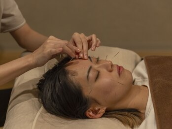 はり結の写真/【美と健康を整える、自分に向き合う時間】美容鍼灸で育む、自然で美しい「フェイスライン」と「つや肌」。