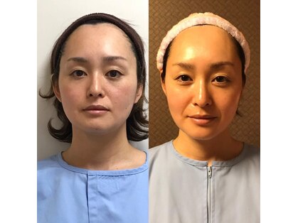 いろはりの写真
