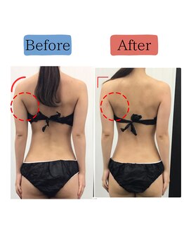 ステイゴールド美容整体院(STAY GOLD)/後ろ姿も美人になりましょう☆