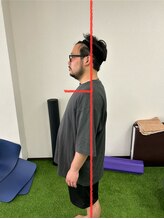 サンライズスポーツアカデミー(Sunrise Sports Academy)/ストレッチ整体*Before