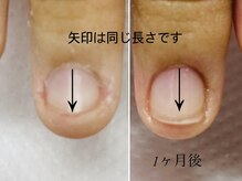トゥインクリーネイルサロン(Twinkly Nail Salon)/【最強のネイルケア】1回お試し