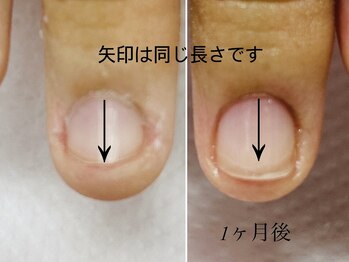 トゥインクリーネイルサロン(Twinkly Nail Salon)/【最強のネイルケア】1回お試し