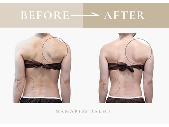 ママリスサロン(Mamariss Salon)/【骨盤矯正 1回の変化】