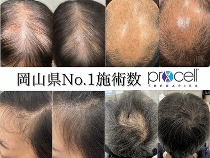 ラポノンプラス(La ponon+)の写真
