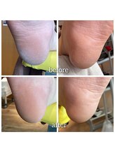 爪切り屋 足楽/