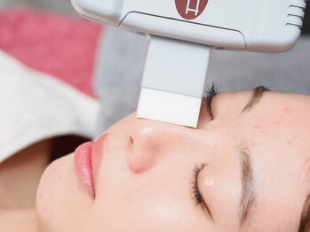 シェリー(cheri)の写真/つい触りたくなる素顔を手に入れる！カミソリの自己処理から卒業☆顔脱毛で肌悩みを解消しましょう♪