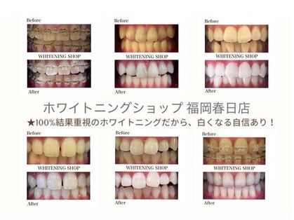 ホワイトニングショップ 福岡春日店の写真