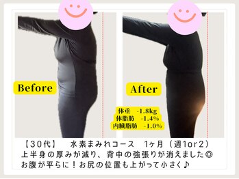 ヨサ パーク モモ(YOSA PARK MOMO)/大人気◇水素まみれコース