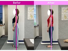 八女整体院/～姿勢改善～肩こり