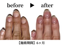 リング ザ ベル(ring the bell)/深爪スタンダードコース¥11,000