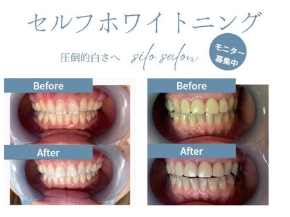 シロサロン(silo salon)の写真