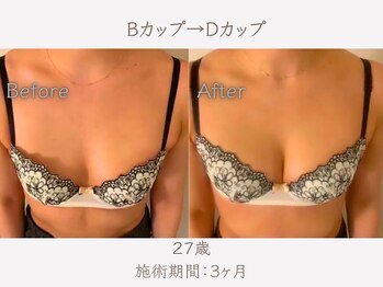 ハリスタ 天王寺院(HARISTA)/3ヶ月間でBカップ→Dカップ