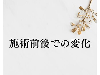 望鍼灸院/施術前後での変化