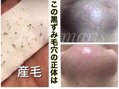 デアマリスの写真