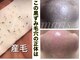 デアマリスの写真
