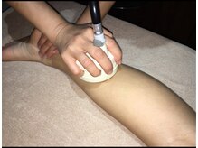 サロンドエミ テラピー(salon de emi)/ふくらはぎセル吸引