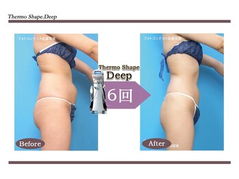 Nビューティー/最新エンダモロジーBODY