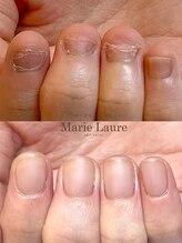 マリーロール 梅田店(Marie Laure)/自爪育成/深爪矯正/ネイルケア