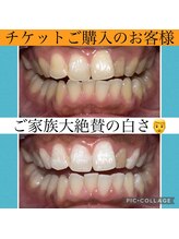 ホワイトニングビューティー 村上店(Whitening Beauty)/ご家族大絶賛の歯に