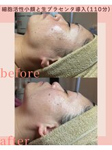 シストワ(sistoi)/小顔と美肌を同時に手に入れる☆